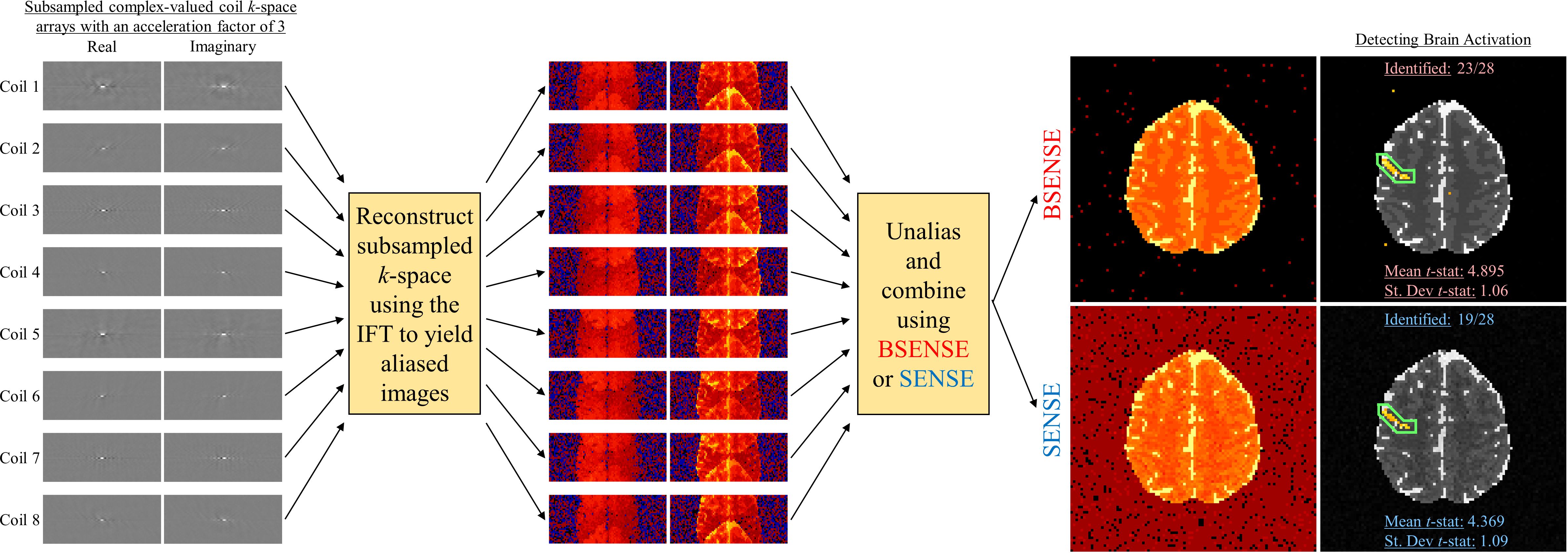 BSENSE reconstruction